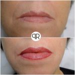 Maquillage permanent lèvres Venelles 13